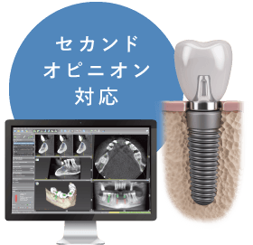 セカンドオピニオン対応